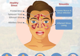 Sinus Headache Treatment
